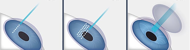 Консультация офтальмолога: влияние месячных на зрение